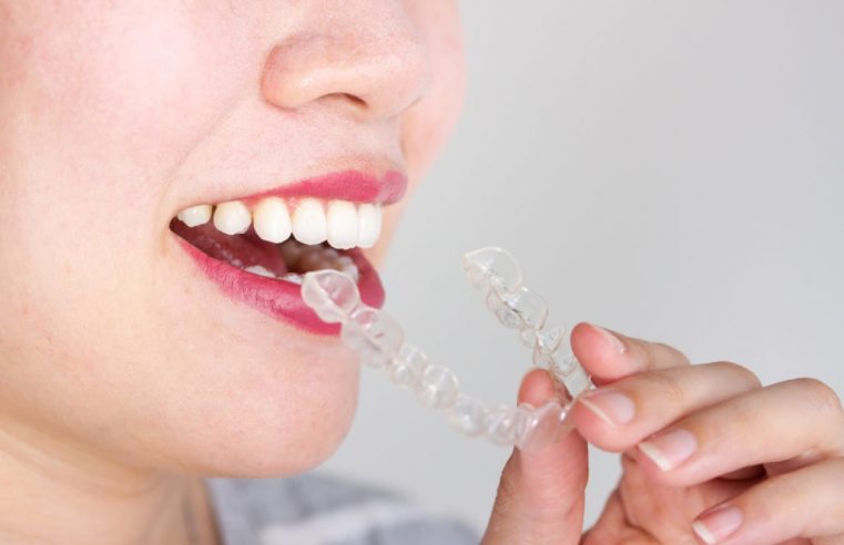 Why You Should Choose Invisalign