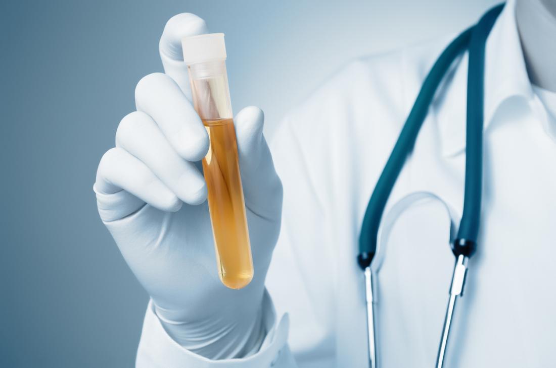 How To Fix The Urinalysis And Where To Buy A Synthetic Replacement