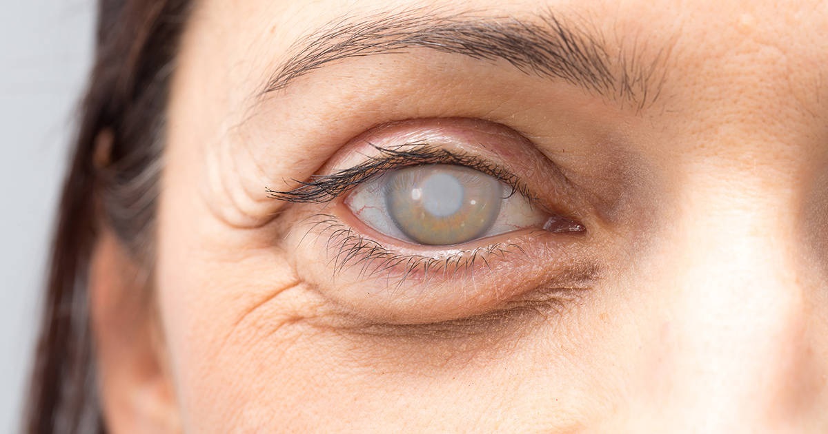 5 Eye Problem Symptoms You Might Be Ignoring