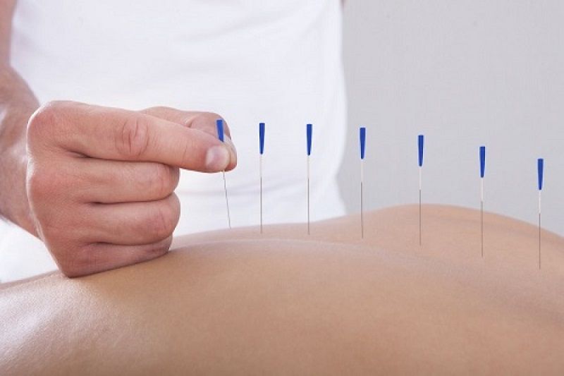 Acupuncture Enhances Fertility