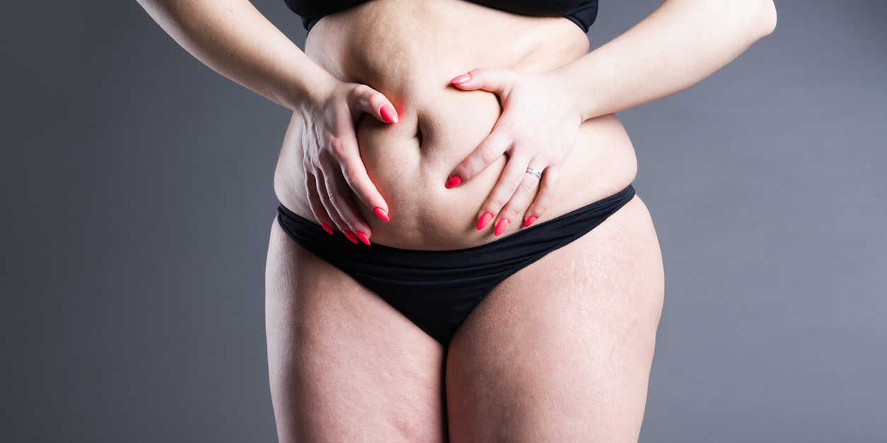 How to Eliminate the Excess Fat and Skin in the Tummy