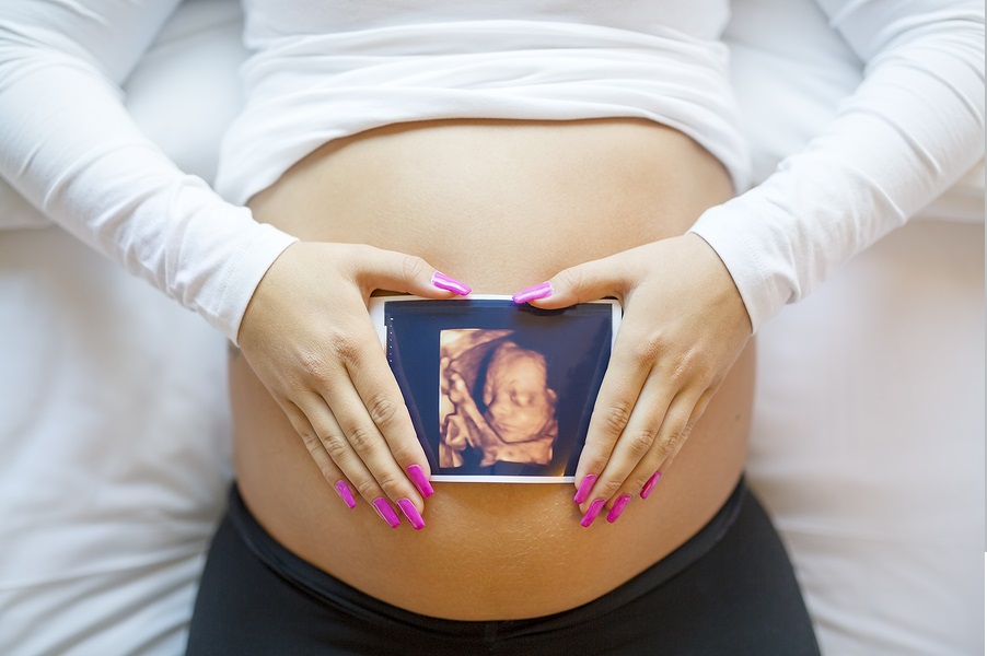 Benefits of 3D and 4D Ultrasound during pregnancy