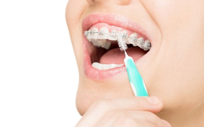 Dental Problems That You All Should Be Aware Of