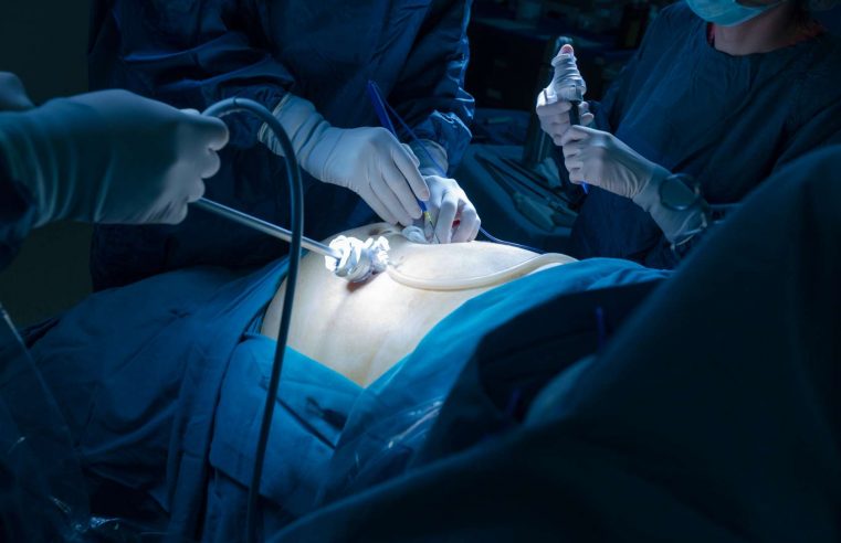 Why You Should Opt for Minimally Invasive Surgery
