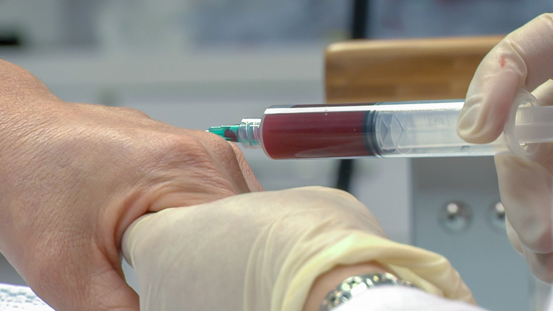 What You Need to Know About Platelet-Rich Plasma