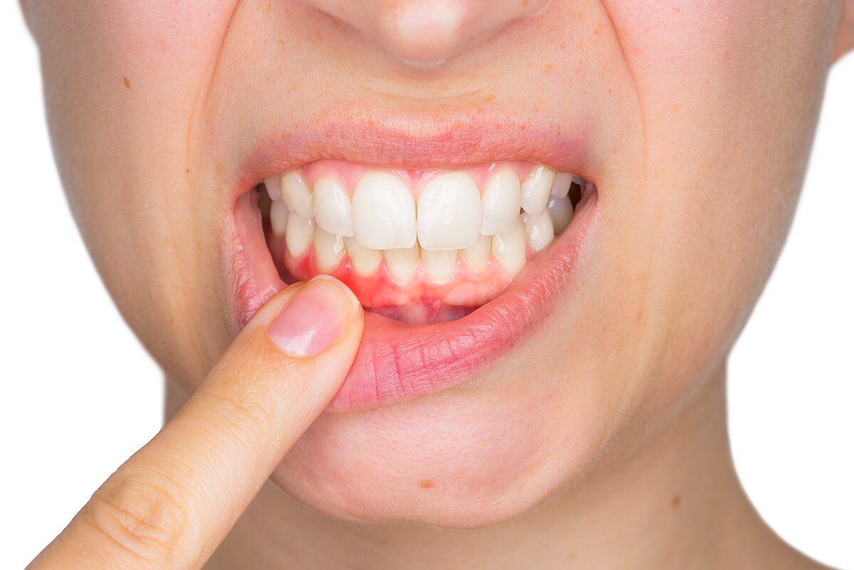 Benefits of Laser Gum Treatment