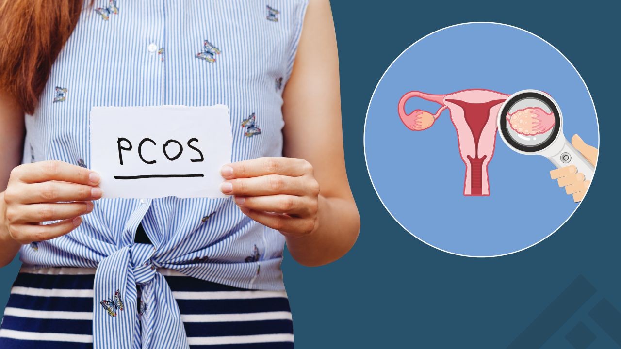 PCOS and You: How to Identify and Treat This Condition