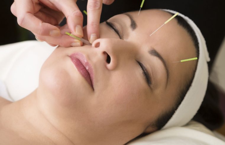 HOW IS ACUPUNCTURE SUITABLE TO GAIN RELIEF FROM HEADACHES?