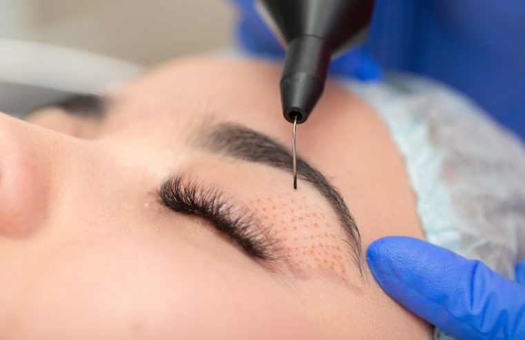 How Eyelid Surgery Improves Your Appearance
