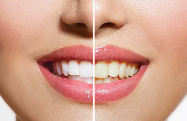 7 Dental Tips to Keep Teeth Healthy