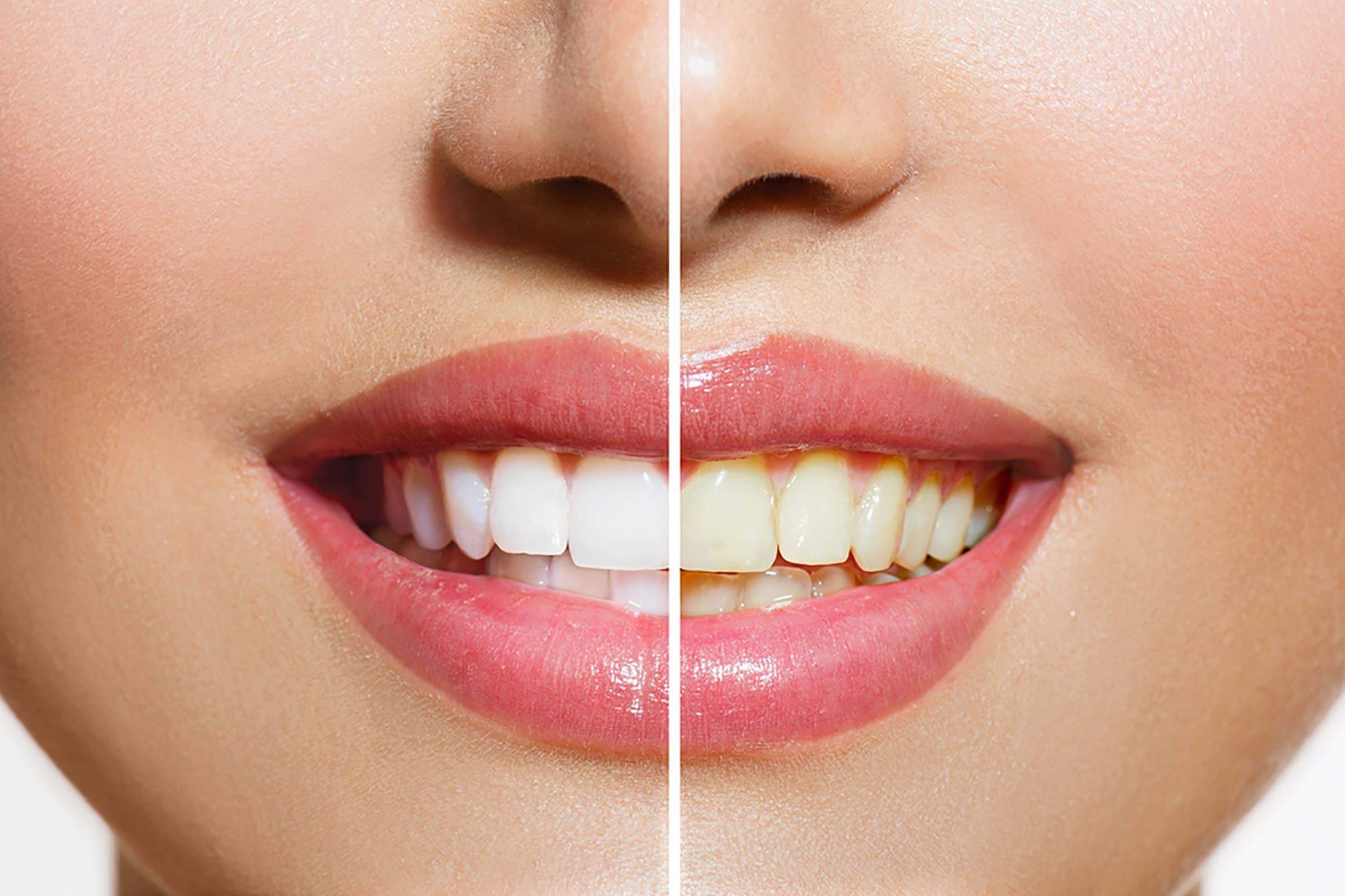 7 Dental Tips to Keep Teeth Healthy