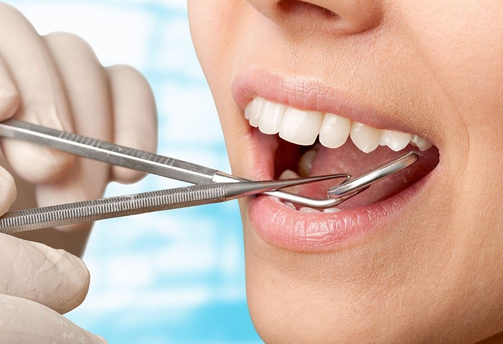 What Is Aesthetic Dentistry: Understand Thoroughly