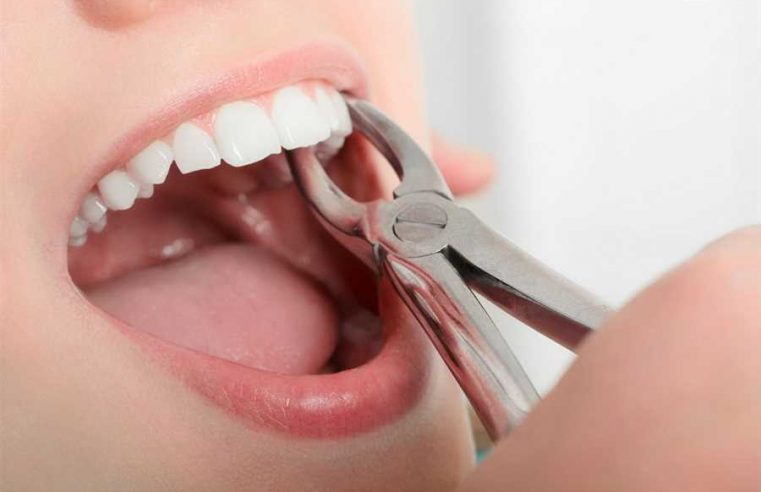 Are There Any Side Effects Of Tooth Extraction?