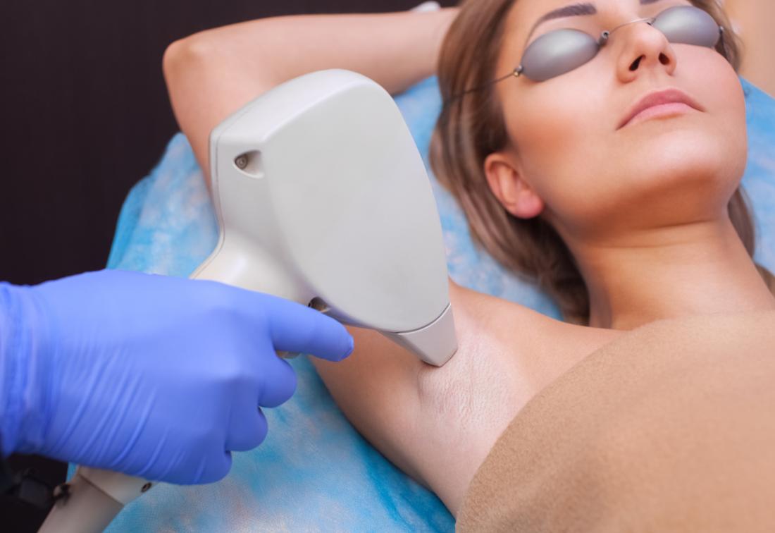 7 Key Benefits of a Laser Hair Removal Procedure
