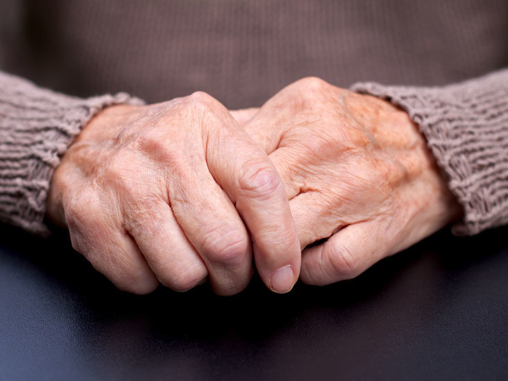 5 Ways to Minimize Your Chances of Developing Arthritis