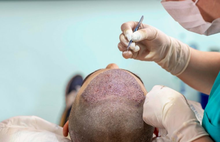 Two Hair Restoration Procedures You Never Knew About