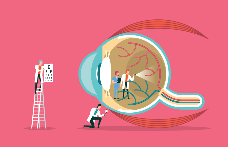 The Essential Glaucoma 17-Point Checklist